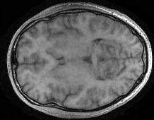Test example 1: selfdb baseline, shown with the same brightness scale as the other images.